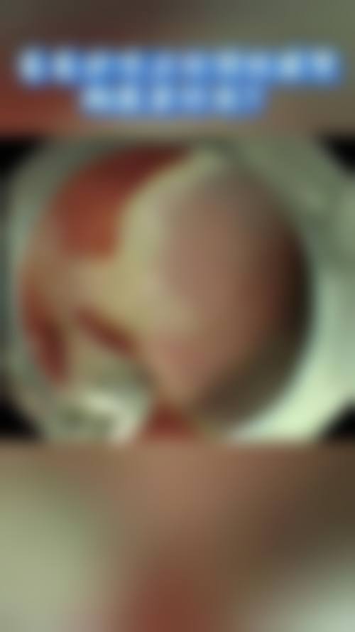 重庆妙颜整形医院怎么样口碑好不好？附真实患者口碑评价