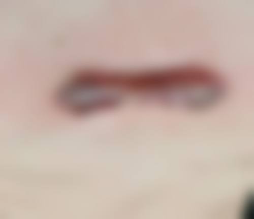 杭州4ever（杭州弗艾弗）医疗美容门诊部怎么样