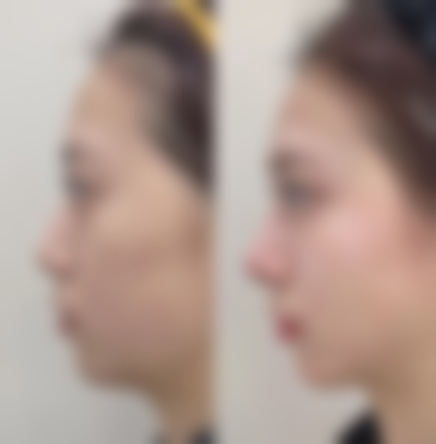 武汉蜜雅琦珂整形医院口碑：真实患者评价