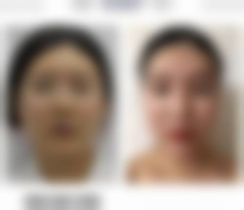 嘉兴浣莎医疗美容门诊部价格表