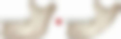 杨凡医生简介做手术价格