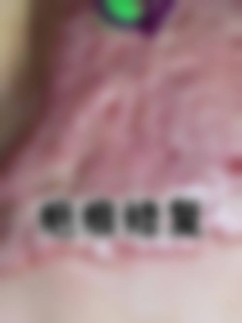 大庆油田总医院整形美容科价格表