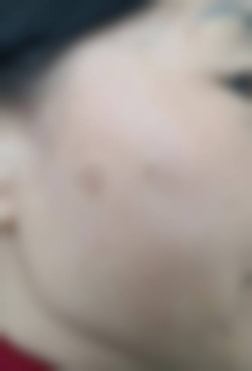 南宁美闺医疗美容门诊部怎么样