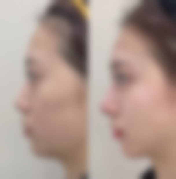 上海光泽和悦医疗美容门诊部怎么样