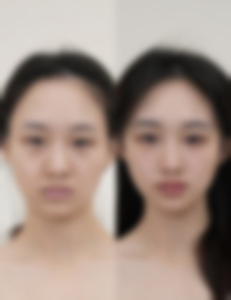 张文俊医生做手术价格