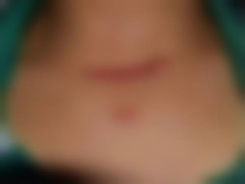 东莞瓷美人医疗美容门诊部更擅长什么