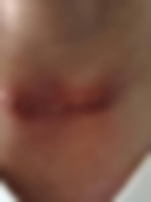 甘春柳医生简介项目优势