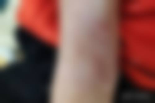 东莞雍禾医疗美容门诊部顾客实例