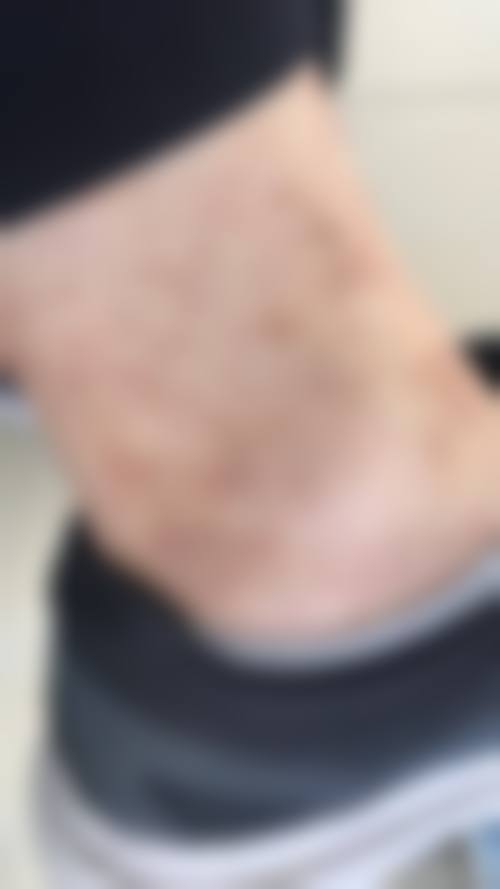 青岛贝莱漾美医疗美容诊所可靠吗