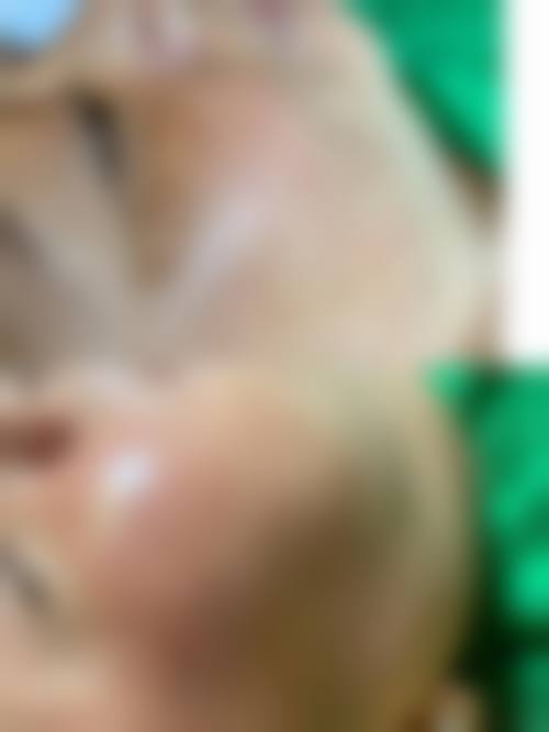 东莞瓷美人医疗美容门诊部价格表