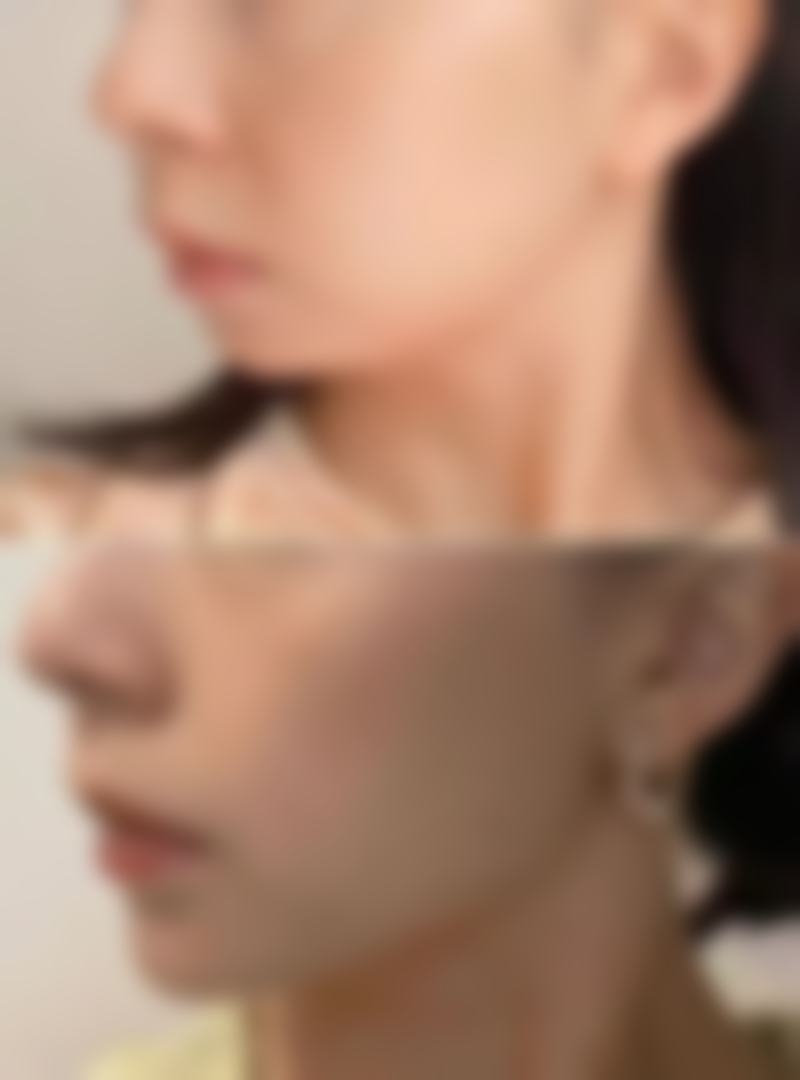 赵元辰医生项目优势