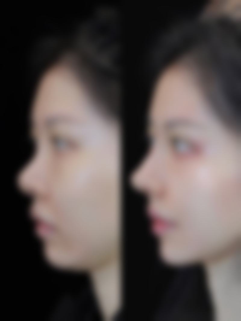 成都菲思丽致整形医院怎么样价格表