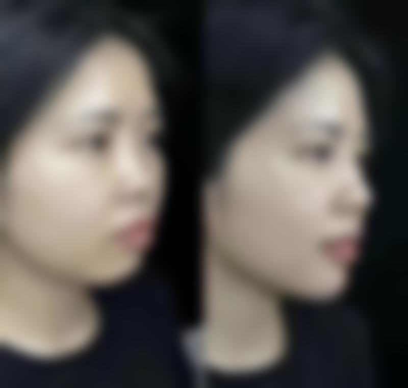 赵元辰医生口碑如何