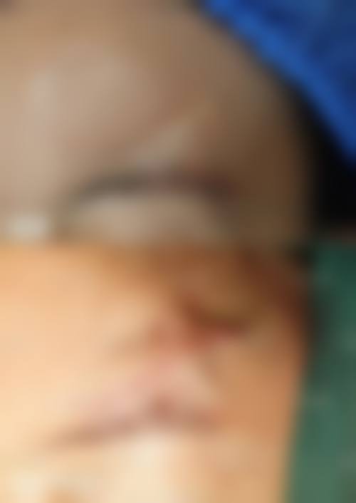 黄晓雯医生简介项目优势