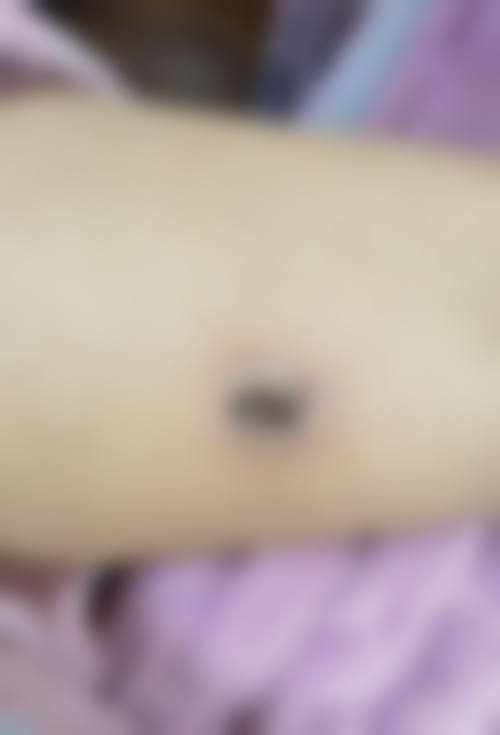 乌鲁木齐美呈医疗美容门诊部怎么样，有顾客实例吗