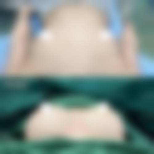 七、国内医 科 大学附属盛京医院整形美容外科真实口碑好不好