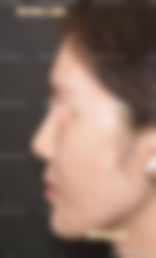 广西柏琳悦美医院怎么样项目特色