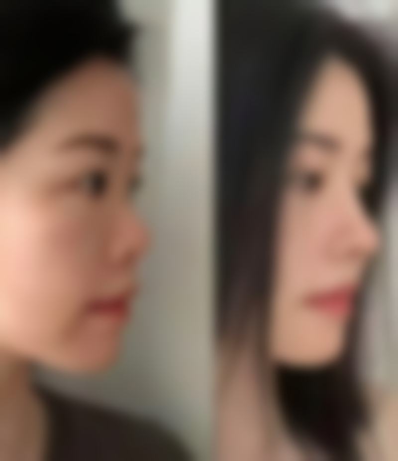 徐军校医生做手术价格