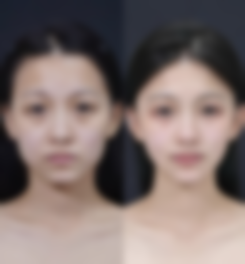 绍兴柯桥金柯桥医院价格表