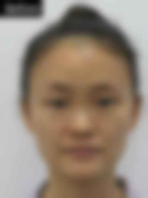 北京印正山整形医院价格表