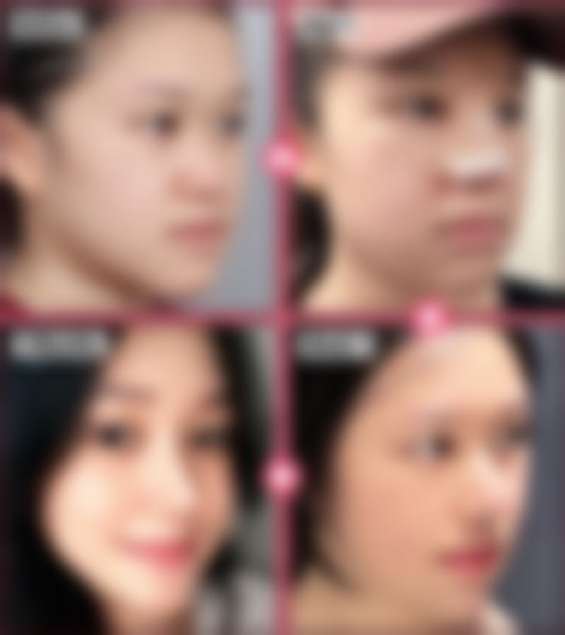 哈尔兰积医疗美容诊所价格表