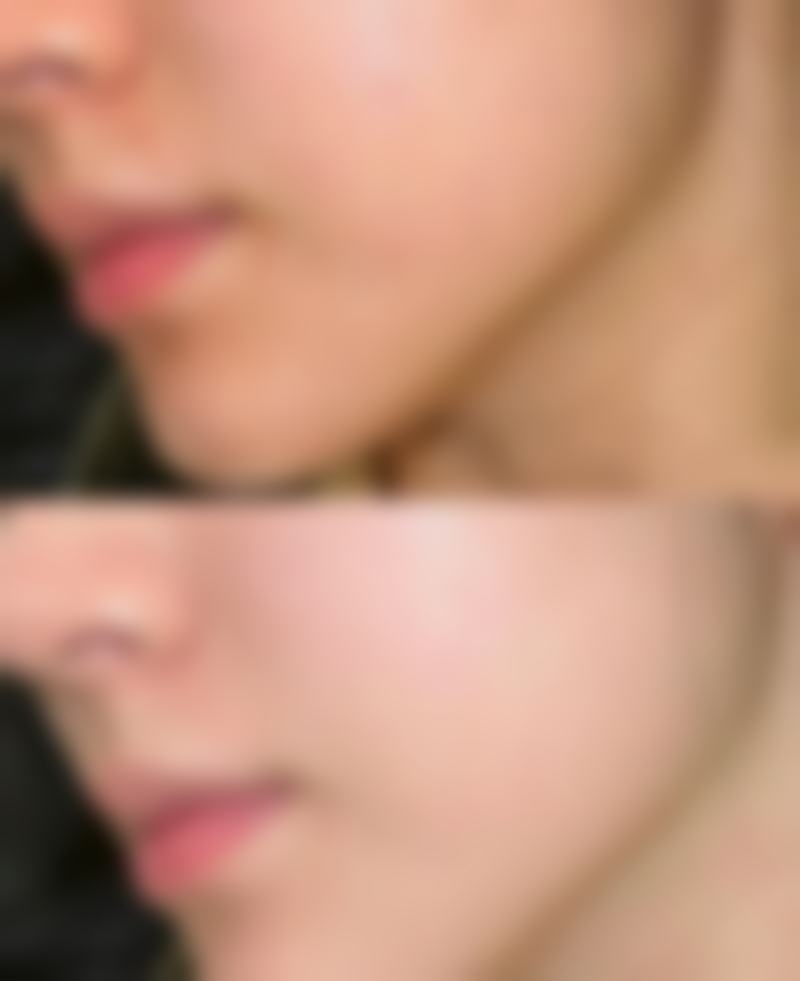 北京印正山整形医院口碑好不好