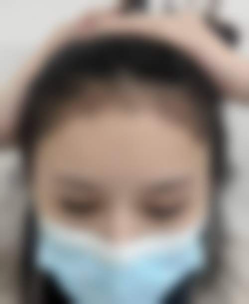 上海大麦植发医疗美容门诊部（原科发源植发机构）地址在哪里