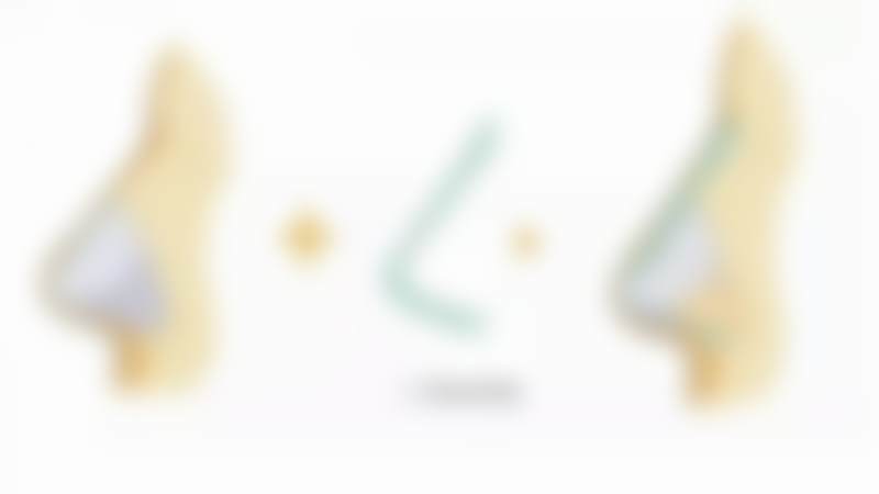 金炳湘医生做手术价格