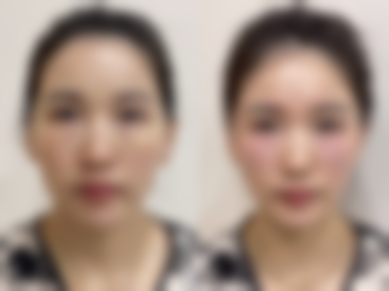 赵晓丽医生简介项目优势