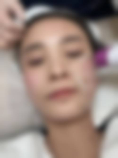 南京铂妃思医疗美容门诊部顾客实例