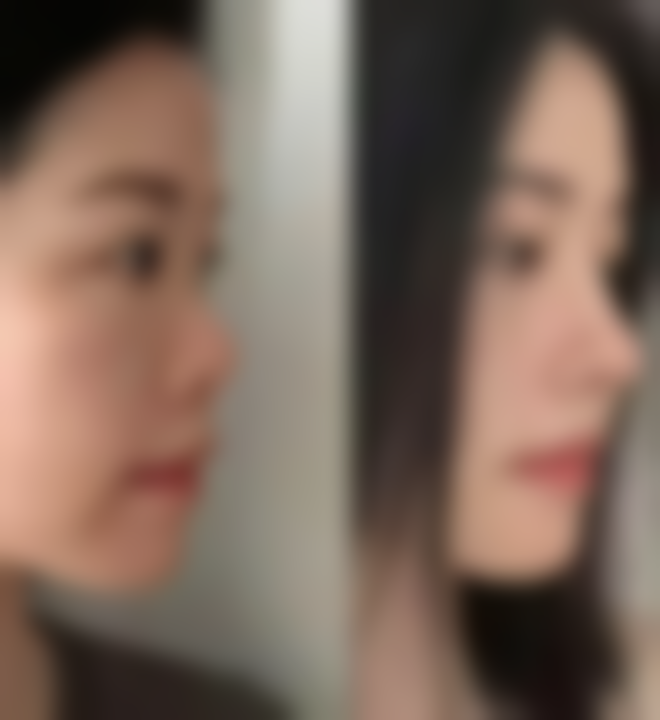 成都暄妍医学美容医院怎么样之口碑好不好？附真实患者口碑评价