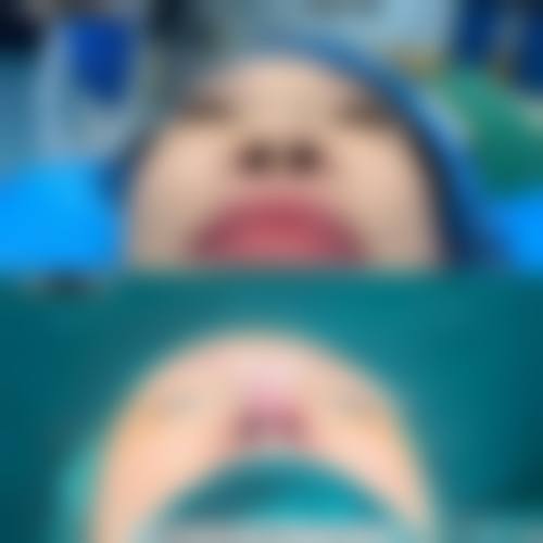 邵军 医生简介做手术价格