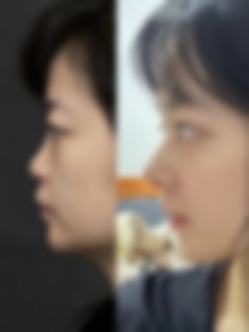 廊坊蓝天医院医疗美容科项目特色