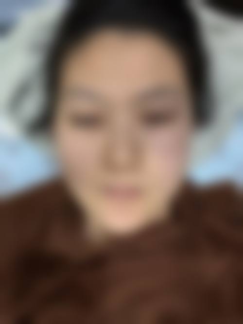 东莞紫芯医疗美容医院口碑好不好