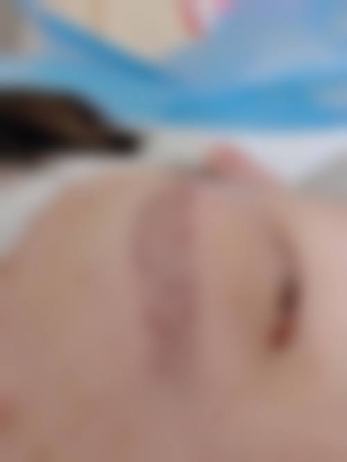 孔华斌医生项目优势