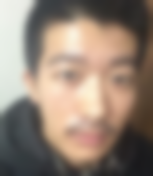 韩国4ever整容外科口碑好不好