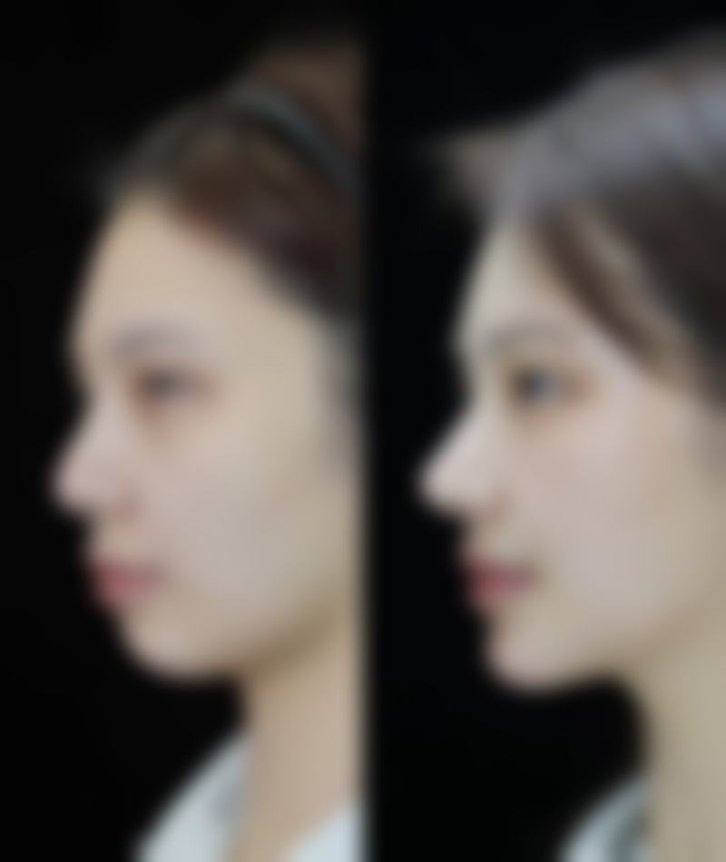 孔华斌医生做手术价格