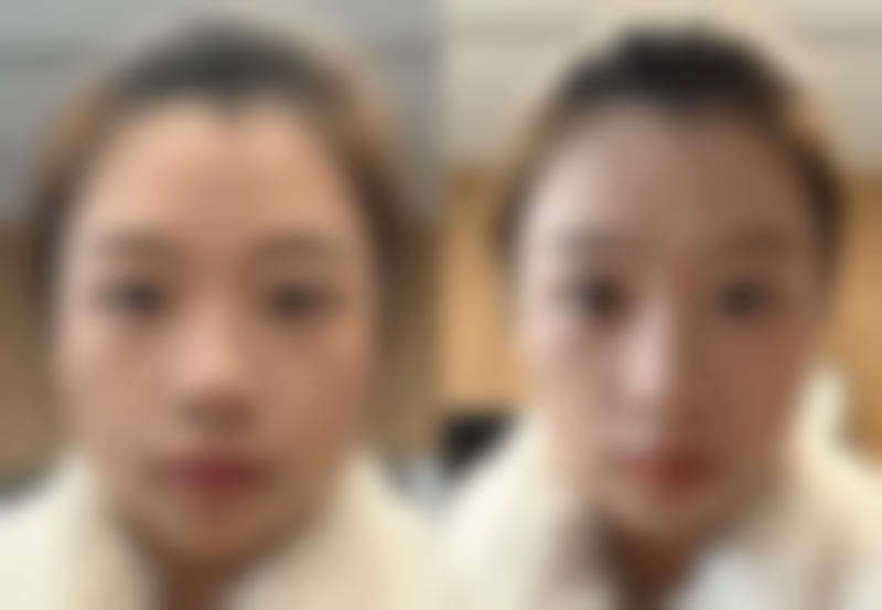 滕可颖医生简介项目优势