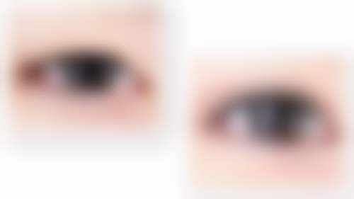 上海艾者医疗美容门诊部(凯迪金融大厦店)怎么样