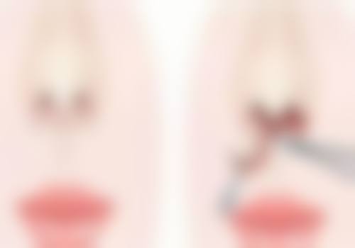 临沂兰山杨加峰医疗美容诊所更擅长什么