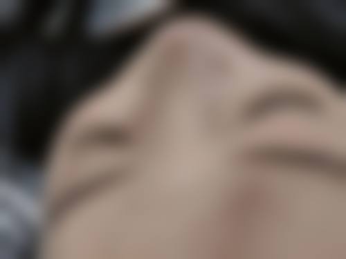 临沂兰山杨加峰医疗美容诊所评价