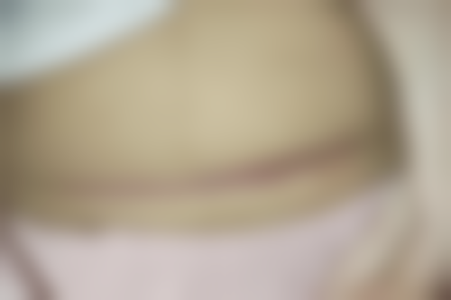 朴贤敬医生做手术价格