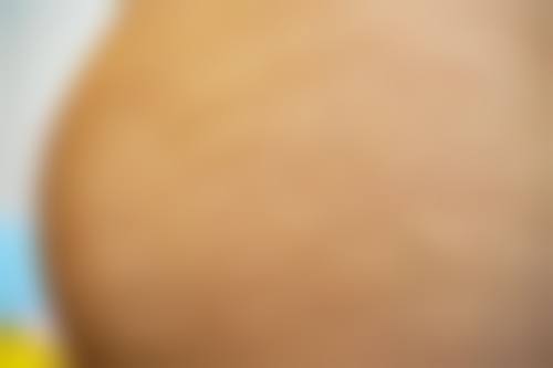 临沂兰山杨加峰医疗美容诊所怎么挂号，地址在哪儿