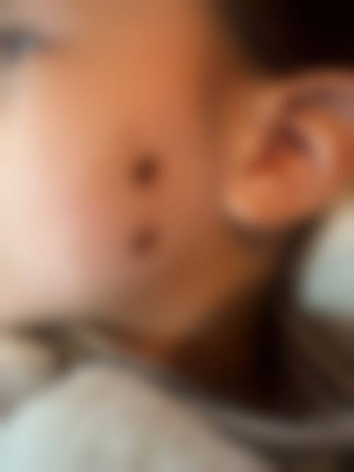 合肥LinCos医学美肤诊所评价