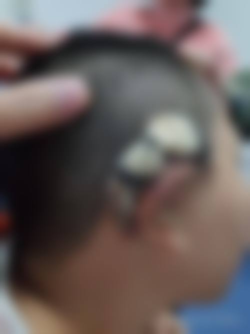 宜昌阿芙罗整形医院口碑评价如何