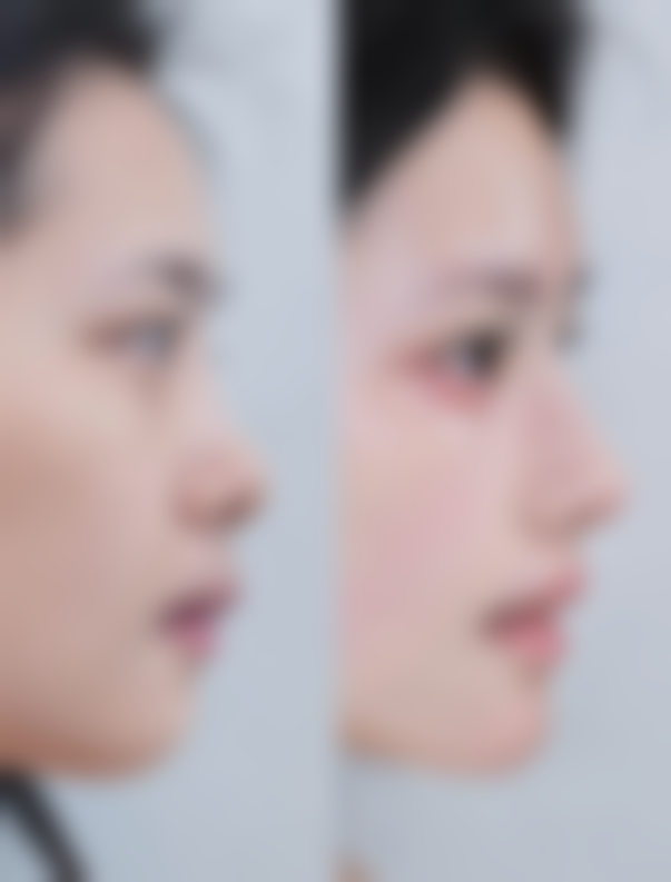 杜芙蓉医生顾客实例图片