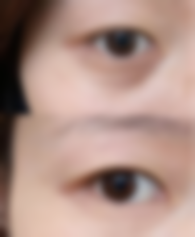 临沂兰山杨加峰医疗美容诊所价格表