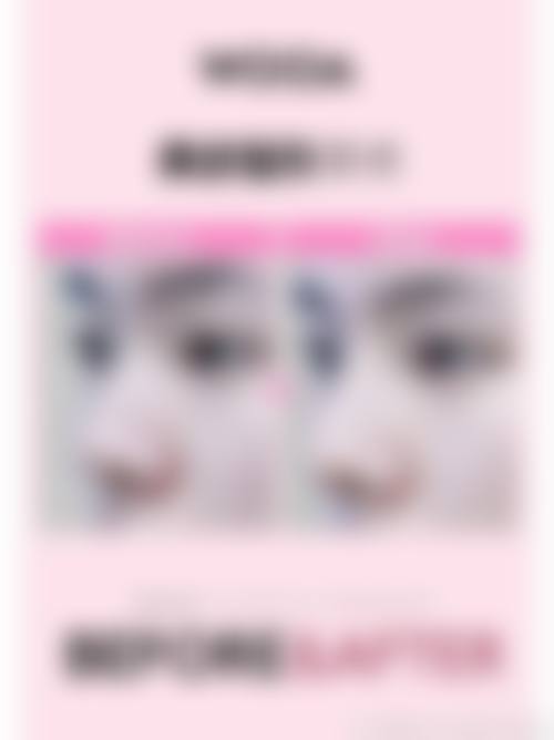 三、开原兰森整形医院怎么样，口碑评价如何？