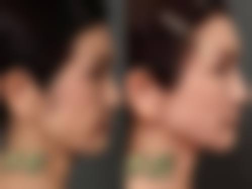 灌南陈佳医疗美容诊所怎么挂号，地址在哪儿