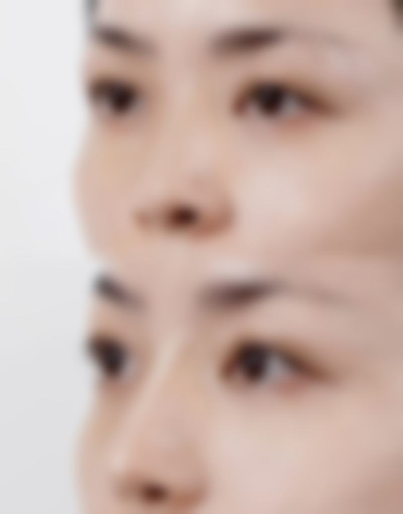 七、开原兰森整形医院口碑好不好？附真实患者口碑评价